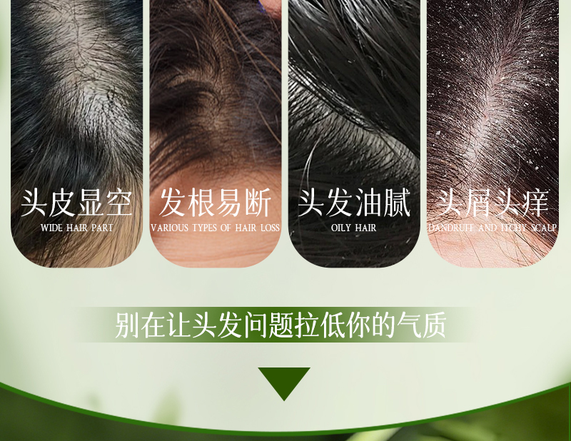 芦氧洗发皂-04痛点展示-头皮显空-发根易断-头屑头痒