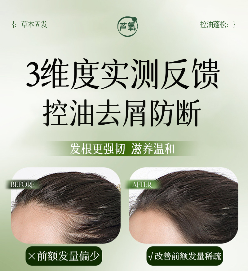芦氧洗发皂-07功效对比-3维度实测-前额发量-发根强韧